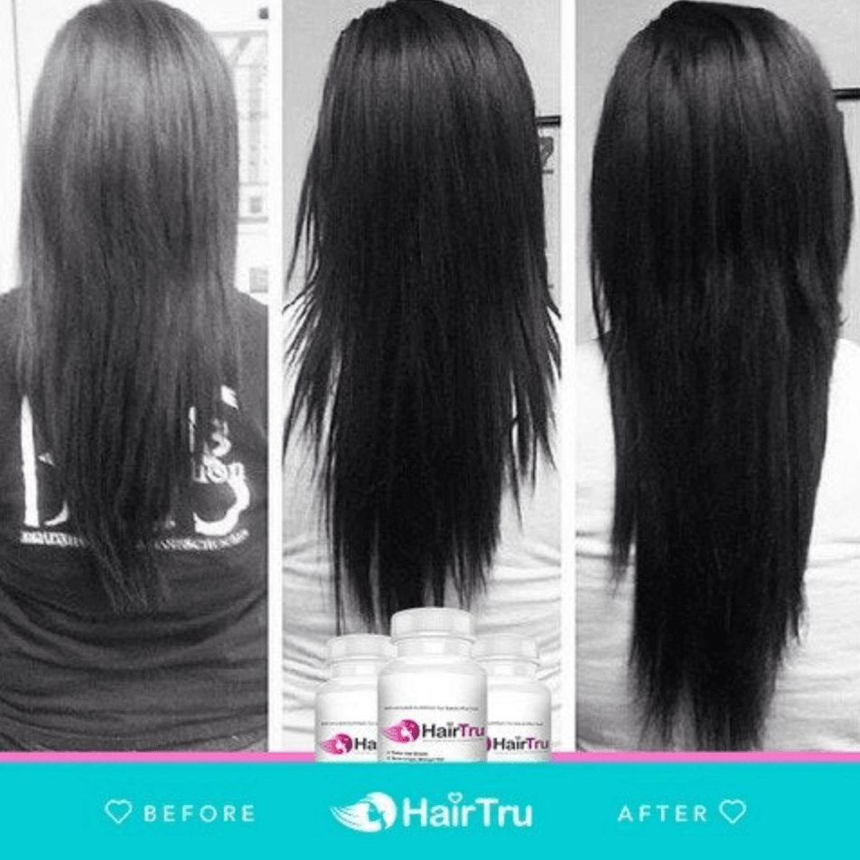 Biotin vs Prenatal vitamins for Hair Growth: Which Vitamins Work and Which Vitamins Do Not? - HairTru Vitamins