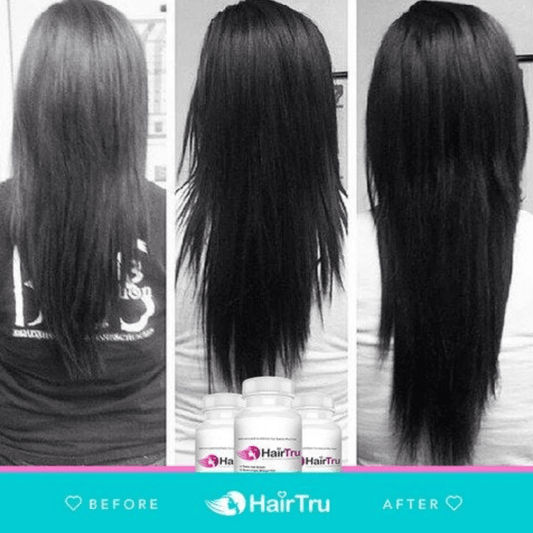 Biotin vs Prenatal vitamins for Hair Growth: Which Vitamins Work and Which Vitamins Do Not? - HairTru Vitamins